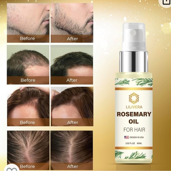 NEW Lilivera Rosemary Oil Hair Regrowth Treatment for Women + Roller 2.0 fl oz - Picture 6 of 7